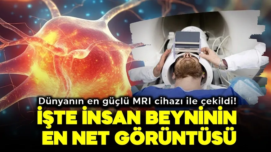 İşte insan beyninin en net görüntüsü..