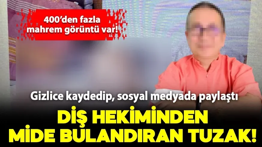 Diş hekimi hastalarının mahrem görüntülerini kaydedip paylaştı...