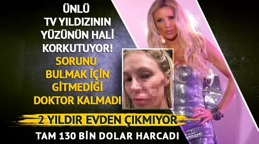 Ünlü TV yıldızının yüzünün hali korkutuyor!  