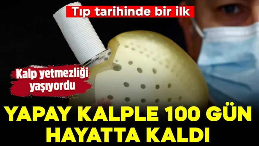 Yapay kalple 100 gün hayatta kaldı