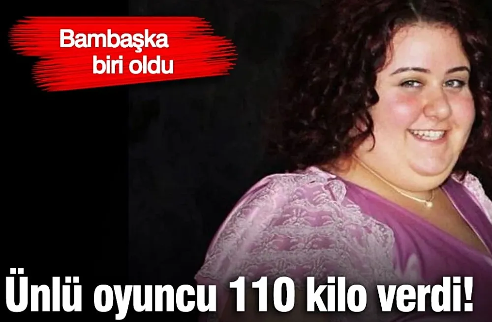 Gören tanıyamıyor! Aslı Samat mide küçültme ameliyatı oldu...