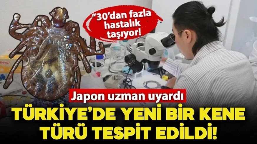 Türkiye