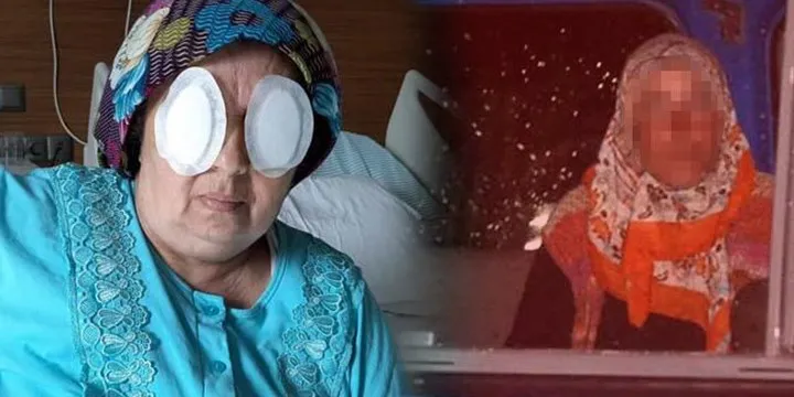 Seri Dehşet!  Baltalı kadın, ikinci kez yatalak hastanın gözlerini çıkardı...