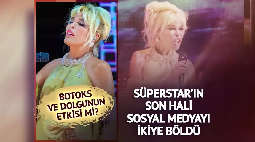 Botoks rezaleti! Ajda Pekkan