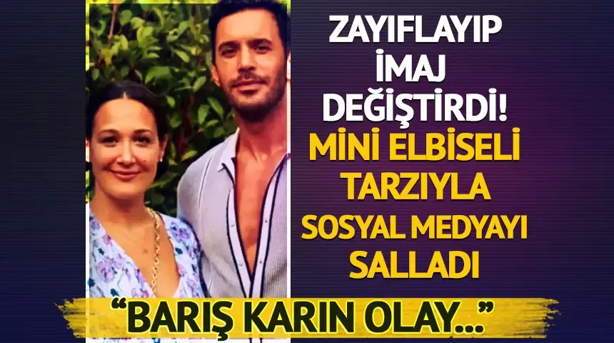 Gupse Özay zayıfladı; mini elbiseli tarzı ve değişimiyle adından söz ettird