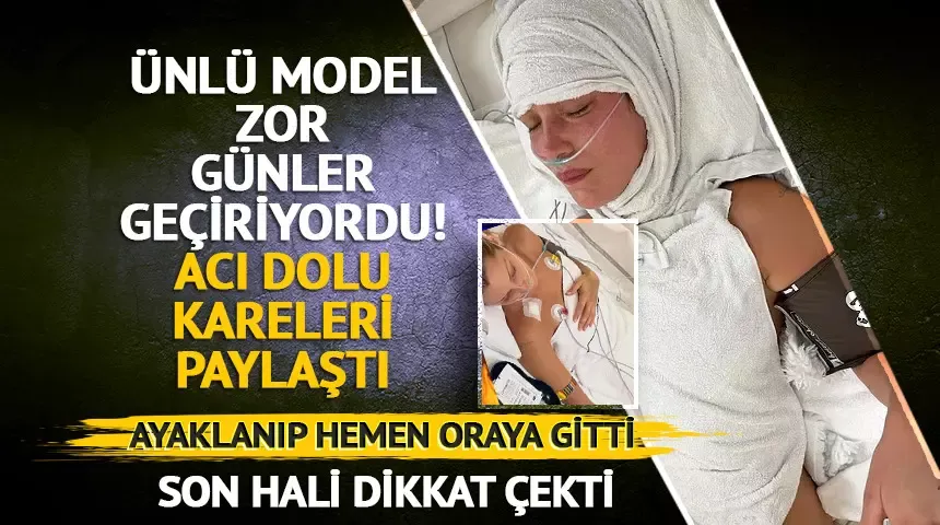 Bella Hadid Lyme hastalığı ile mücadele ediyor! 