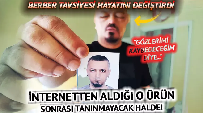 Berberin tavsiyesine uydu, arı sokmasından beter hale geldi
