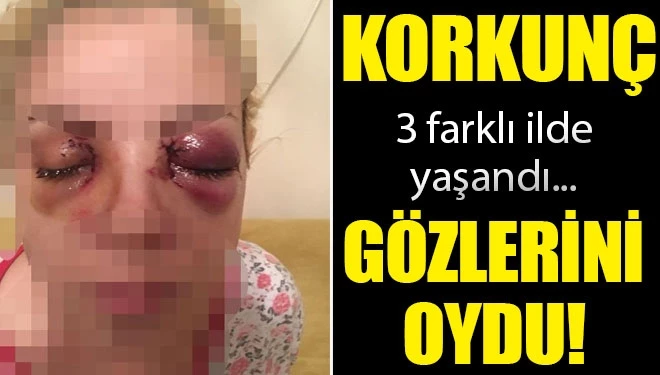 Dehşet anlarını anlattı! Diş fırçasıyla gözlerini oymaya çalıştı
