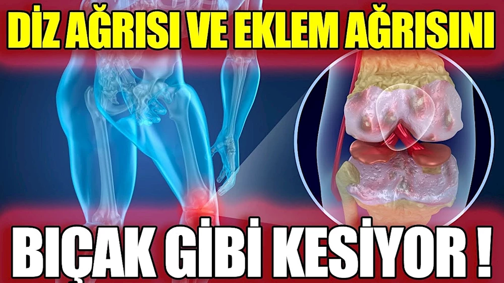 Dizlerdeki ağrıyı geçirmenin en etkili yolları